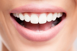 Bone Grafting at Timothy H. Kindt, DDS Bone Grafting at Timothy H. Kindt, DDS
